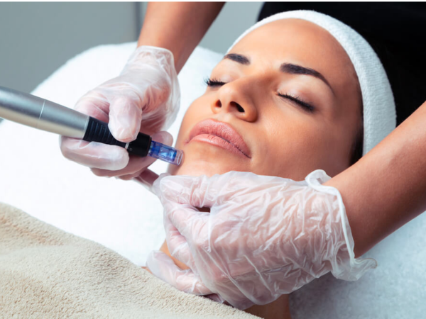 Needling
